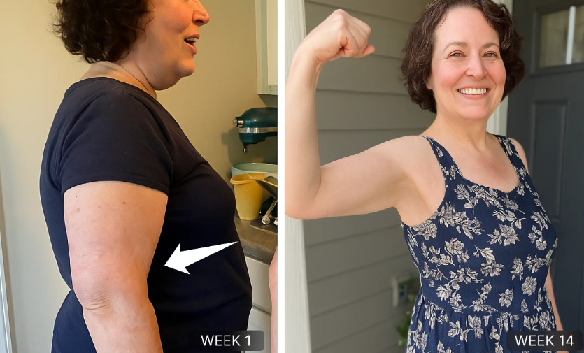 MyoGlow Review 2026: Does This Handheld Non‑Invasive Device Worth It? 11 MyoGlow Before After