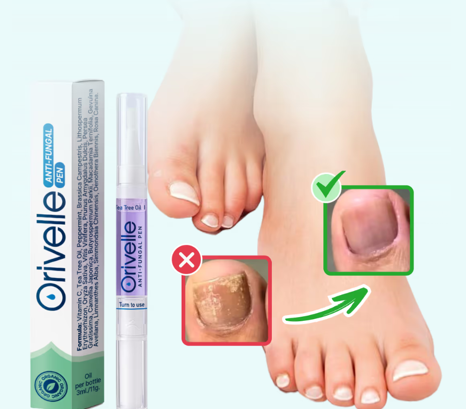 Orivelle Fungus Pen Review (2026): What You Must Know Before Buying 1 Orivelle Fungus Pen Review