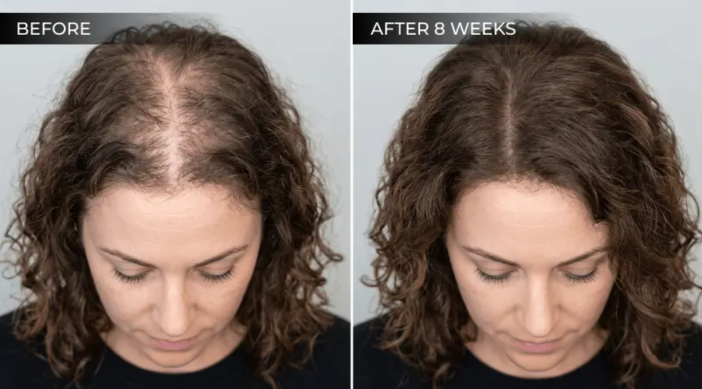 Rovay Red Light Brush Before After